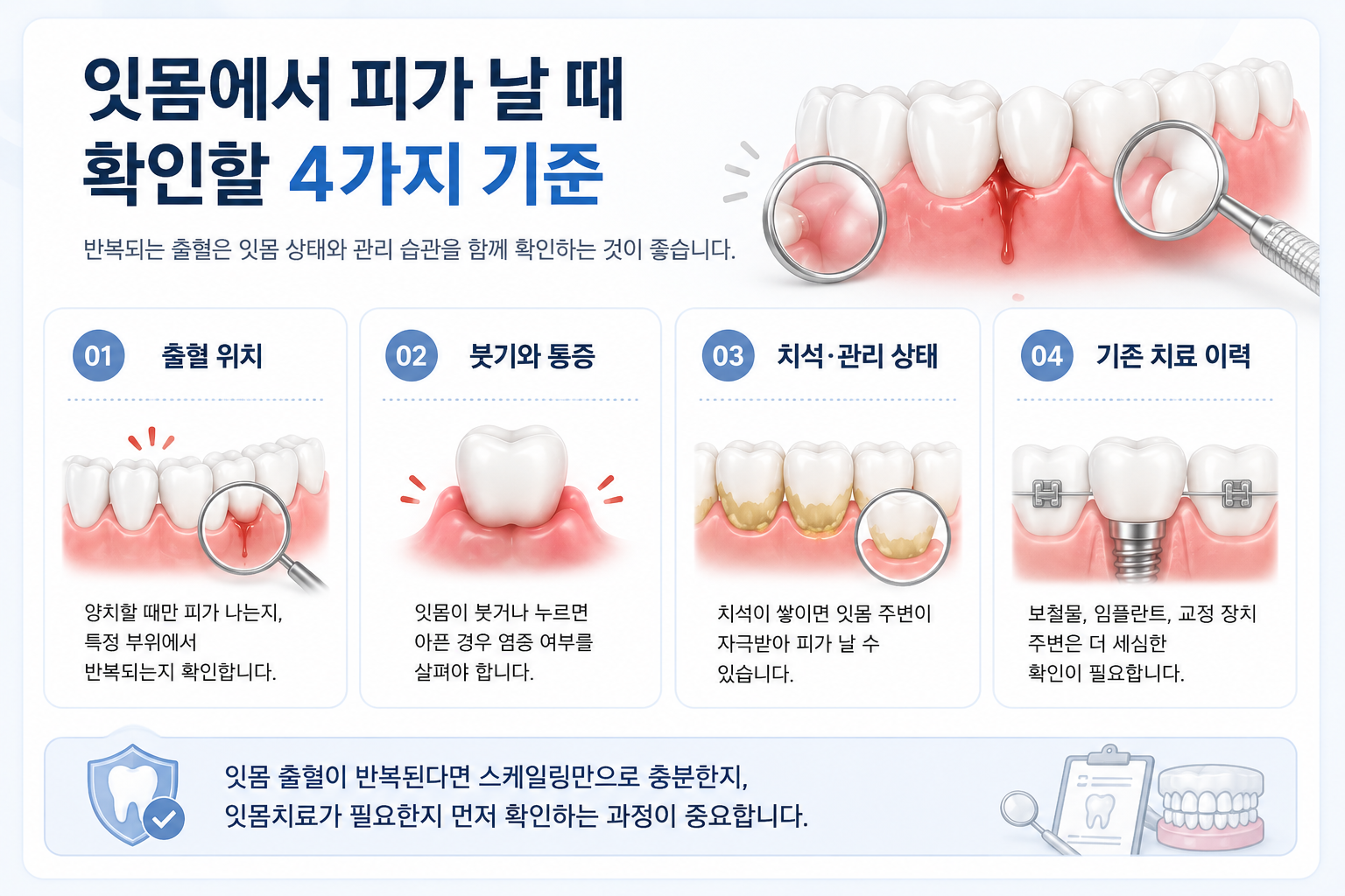구리 잇몸치료 잇몸 출혈 확인 4가지 기준