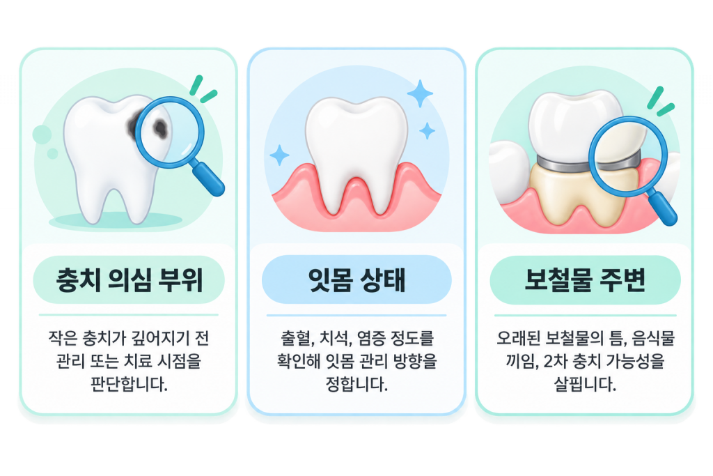 구리 구강검진 안내: 충치 의심 부위, 잇몸 상태, 보철물 주변의 세 가지 확인 항목