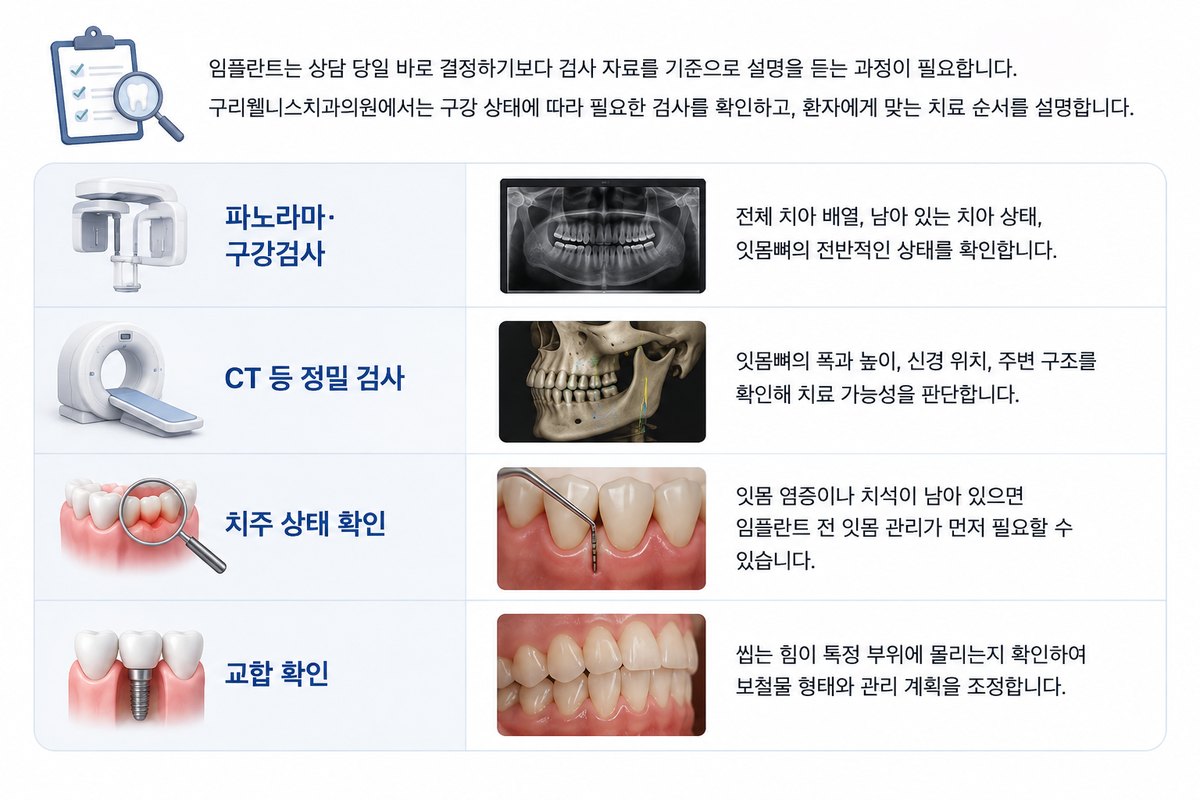 구리 임플란트 상담 검사 자료 핵심 기준