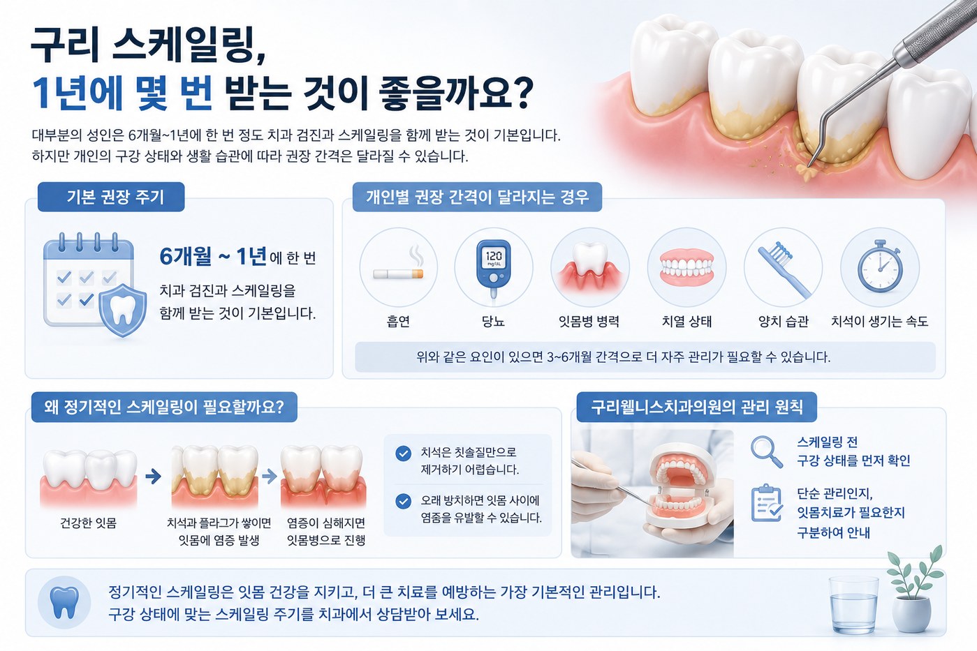 구리 스케일링 1년에 몇 번 받는 것이 좋을까요