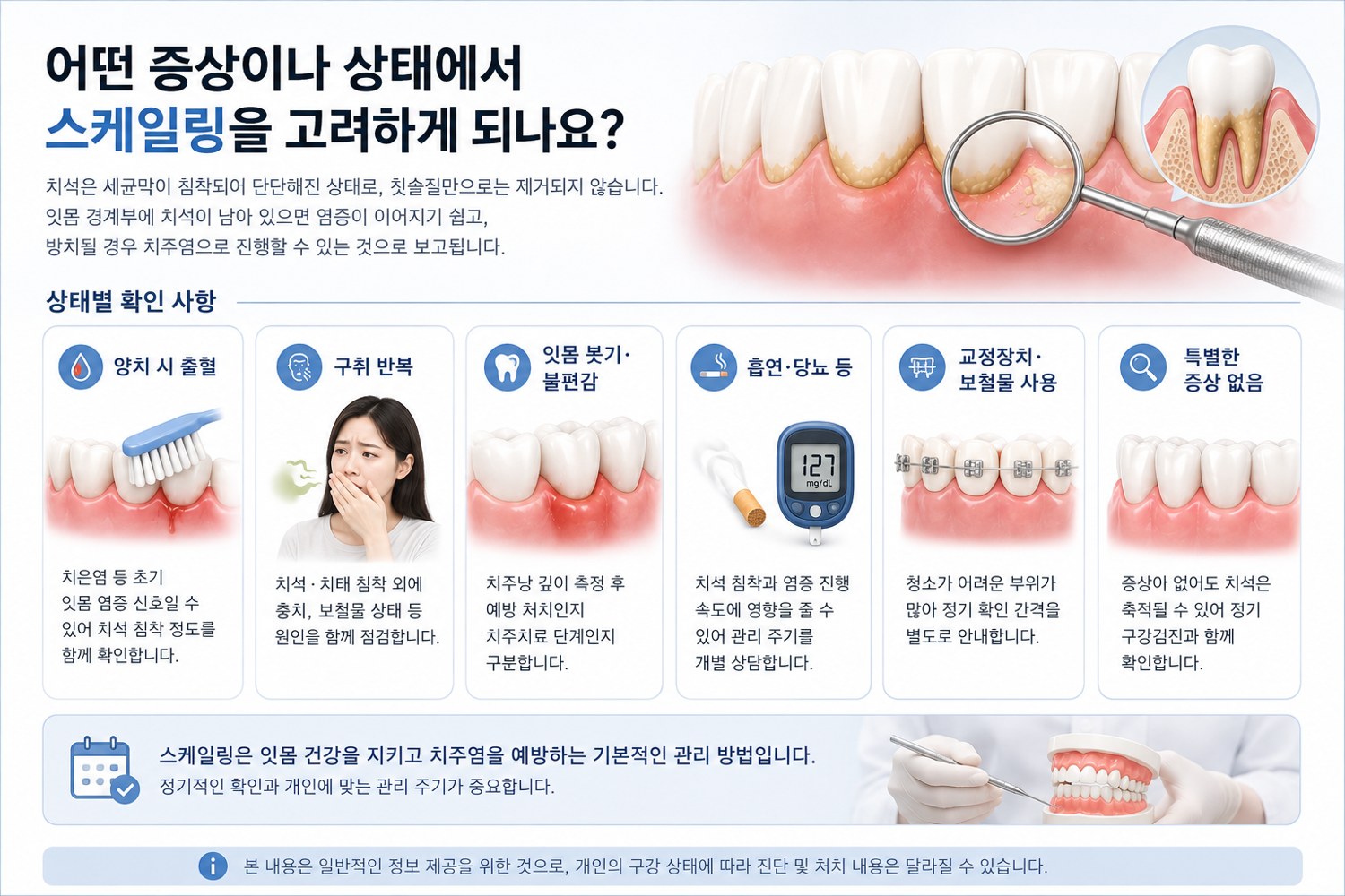 스케일링 건강보험 적용 기준과 구리 스케일링 고려 증상