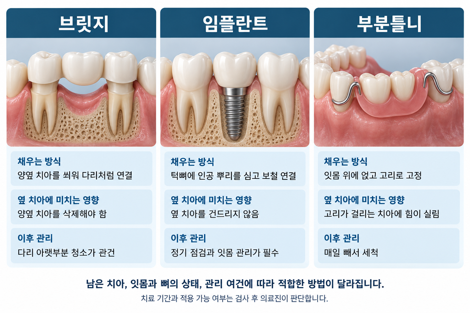 구리 크라운 재료별 비교 — 지르코니아, PFM, 골드, 금속관의 적용 위치와 고려할 점 설명, 구리웰니스치과의원