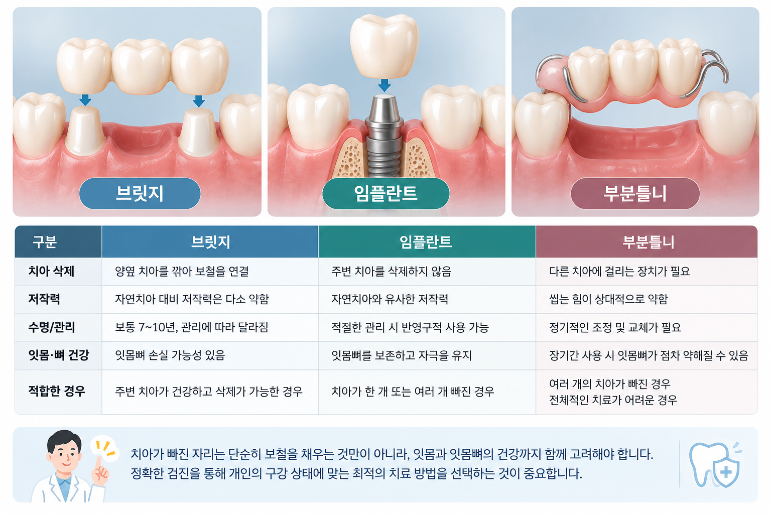 구리 브릿지 임플란트 차이 비교 — 옆 치아 삭제 여부, 치료 기간, 관리 방법 설명, 구리웰니스치과의원