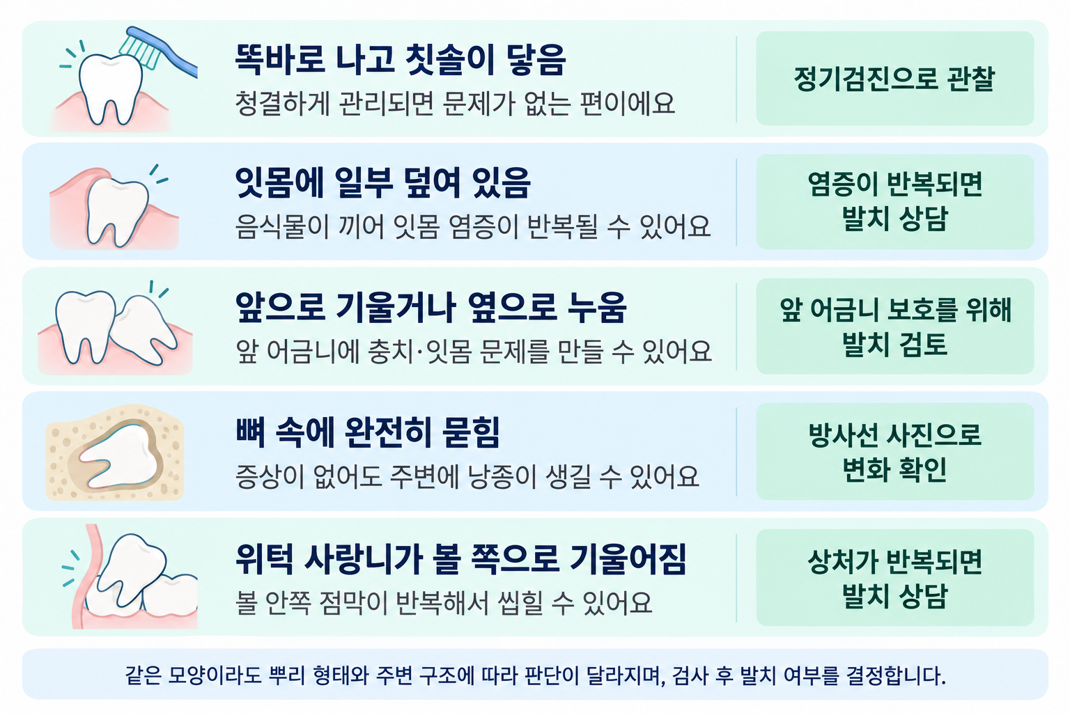 구리 사랑니 발치 판단 기준 비교 — 똑바로 난 사랑니, 부분 맹출, 기울거나 누운 매복, 완전 매복의 차이 설명, 구리 갈매 치과